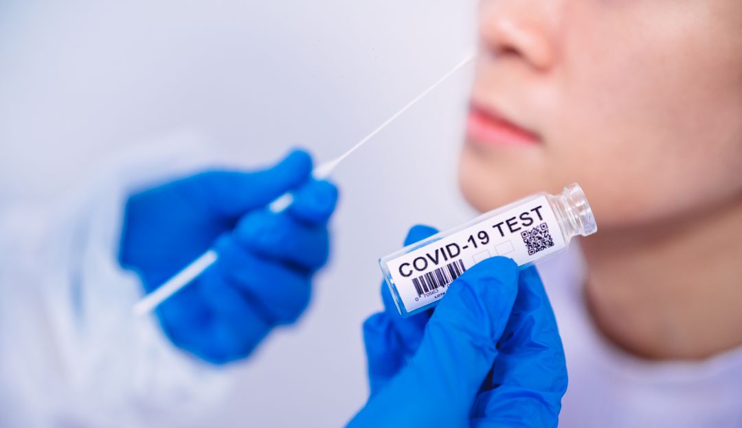 COVID-19 TEST